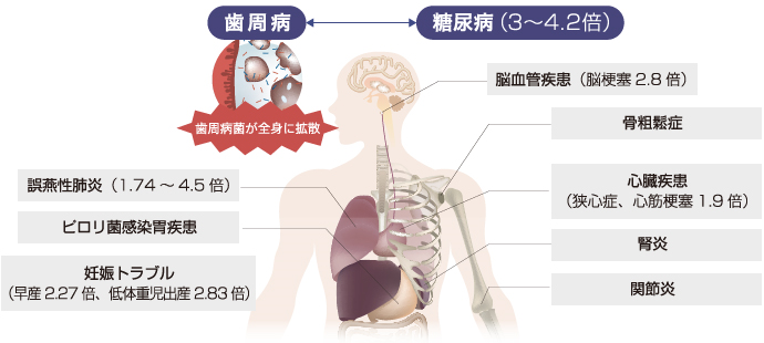 イメージ画像
